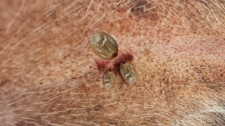 More Than 100 Ticks Were Remove From This Poor Dog - Easy and Quickly To Getting All Ticks Out