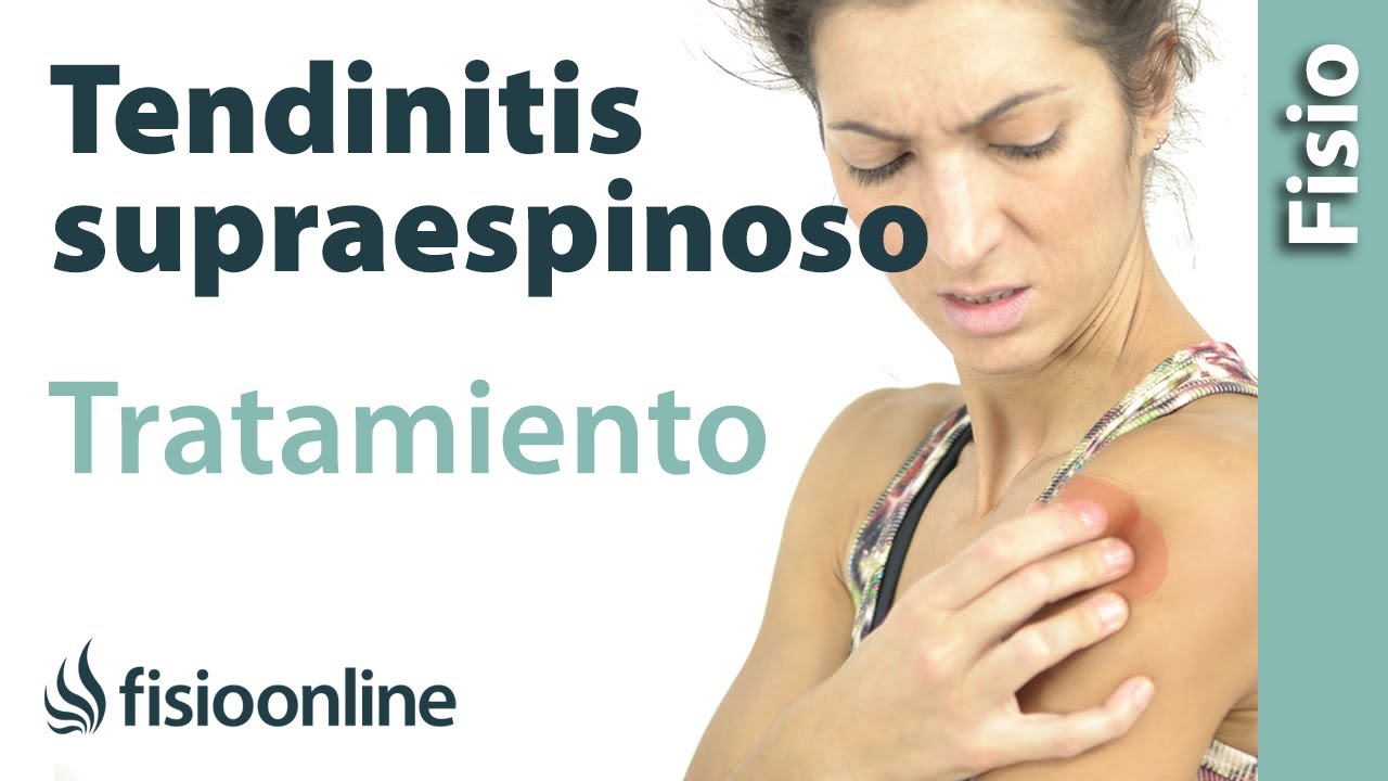 Tendinitis Del Supraespinoso - Tratamiento Con Ejercicios, Automasajes ...