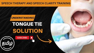 உங்கள் குழந்தைக்கு TONGUE TIE இருக்கிறதா? WATCH IT ! Ankyloglossia - Impact on Speech and Solutions