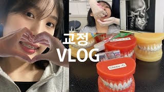 교정VLOG🦷