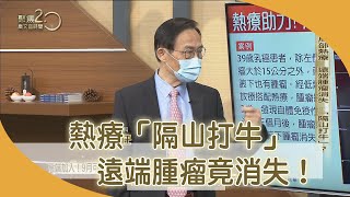 熱療「隔山打牛」遠端腫瘤竟消失！【聚焦2.0】第403集