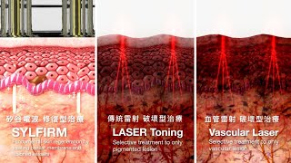 矽谷電波SYLFIRM 養膚新趨勢 重建皮膚生態系 打造不易長斑的健康膚質 - 文山美學診所