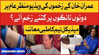 Imran Khan Bullet Wound Footage Released | Exclusive Video Of Injuries | Breaking News