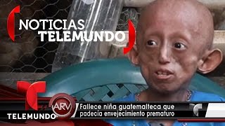 Fallece niña que padecía de envejecimiento prematuro | Al Rojo Vivo | Noticias Telemundo