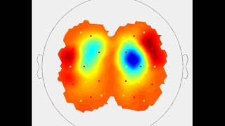 NIRx - nirsLAB analysis software - deoxy-hemoglobin dynamic visualization