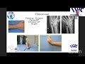 wrist arthroscopy where are we after 35 years of regular practice