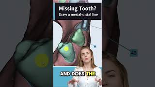 🔵Maestro 3D | Dental Studio Expert | Automatic Tooth Segmentation Tips \u0026 Tricks🔵