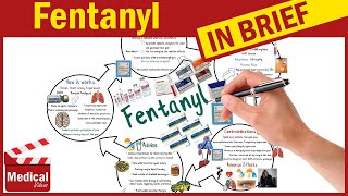 Fentanyl (Sublimaze - Actiq - Duragesic): Fentanyl Uses, Dosage, Side effects \u0026 Precautions