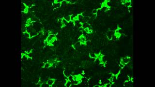 Behavior of Langerhan Cells Under Pathological Conditions