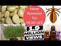 Top 5 Home Remedies To Get Rid Of Head LICE & Nits * Sushmita's Diaries Top 5 Home Remedies To Get Rid Of Head LICE & Nits * Sushmita's Diaries