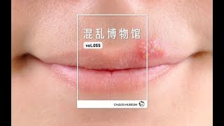 你的嘴唇为什么起泡 | Why is your lips bubbling? | ChaosMuseum