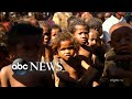 Climate-induced famine leaves children on the brink of starvation: Part 1