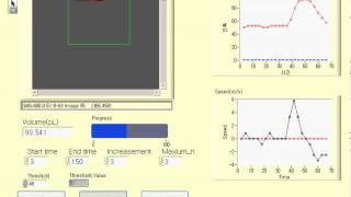 mensicus motion using rectangular ROI