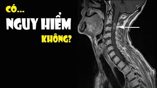 Chụp Cộng hưởng từ MRI có Nguy hiểm không? Hiểu rõ trong 5 phút