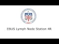 EBUS Lymph Node Station 4R