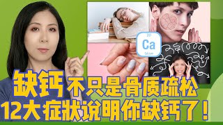 缺钙不只是骨骼疏松，12个身体求救信号说明你缺钙了！