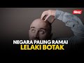 Negara paling ramai lelaki botak