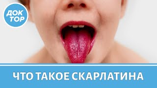 Врач-педиатр о том, как отличить скарлатину от обычной ангины