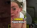 Stop These Pimples Mistakes ❌ | #shorts #viral