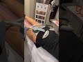 emsculpt booty toning 20 000 squats in 30 minutes fatloss