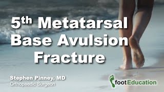 5th Metatarsal Base Avulsion Fracture