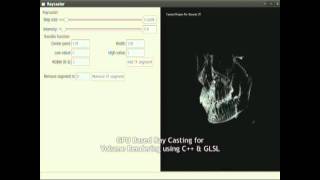 GPU based Volume Rendering using Ray Casting