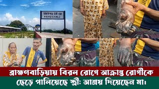 ব্রাহ্মণবাড়িয়ায় বিরল রোগে আক্রান্ত রোগীকে ছেড়ে পালিয়েছে স্ত্রী; আশ্রয় দিয়েছেন মা।