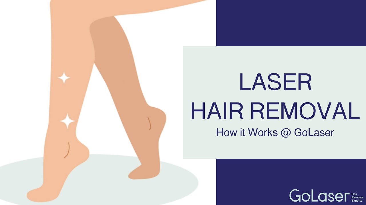 Laser Hair Removal How It Works Golaser Youtube