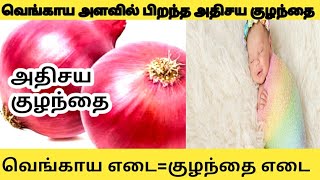 உலகின் மிகச்சிறிய குழந்தை|world smallest baby|baby video@Onnutheriyuma