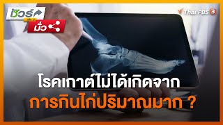 โรคเกาต์ไม่ได้เกิดจากการกินไก่ปริมาณมาก ? : ชัวร์หรือมั่ว