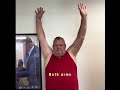 Reverse total shoulder replacement recovery progress 10 weeks after surgery