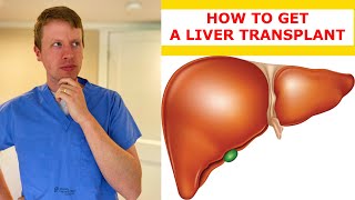 How to Get a Liver Transplant