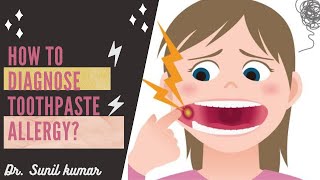 |What to do in patient with TOOTHPASTE ALLERGY?|Dental ji|