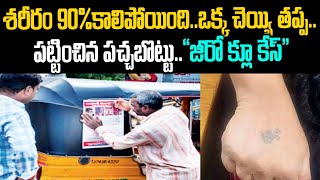 90%బాడీ మొత్తం కాలిపోయింది..ఒక్క చెయ్యి తప్ప..జీరో క్లూ కేసు: పట్టించిన పచ్చబొట్టు | Mr.Venkat Waves