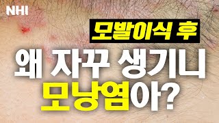 모발이식 후 모낭염이 생겼어요 - 뉴헤어 I [모발이식]