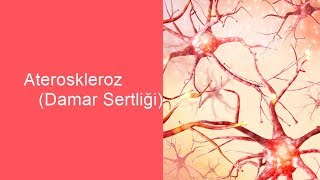 Ateroskleroz (Damar Sertliği) - (Binaural / Isochronic / Enerji Frekansı)