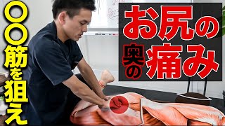 【9割の治療家が知らない】お尻の奥の痛みのメカニズムと神ワザ治療法！