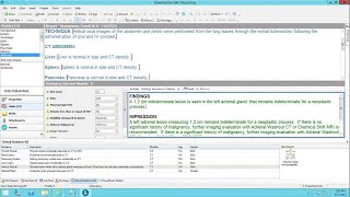 Dr. Tarik Alkasab demonstrates PowerScribe 360 Clinical Guidance