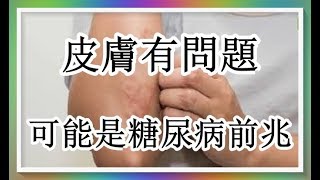 皮膚有問題可能是糖尿病前兆（回應網友）