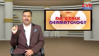 Leprosy Day Special : Causes,Symptoms and Treatment of Leprosy | Doctor's Talk | CVR Health