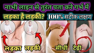 #Nabhi line/गर्भावस्था के दौरान नाभि पर सीधी या टेढ़ी रेखा #Lineanigragenderprediction #babyboy