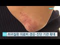 희귀질환 의료비 경감 확대...진단 기관도 추가 지정 ytn 사이언스