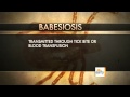 Babesiosis: Illness ticks spread on the rise