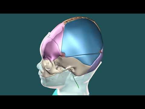 How do you rule out hydrocephalus?