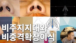 비주지지대와 비중격확장이식