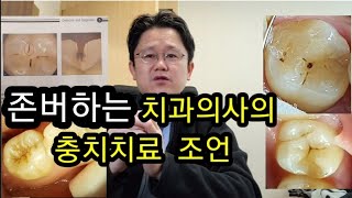 폭망한 치과의사의  초기 충치 치료  주의할 점