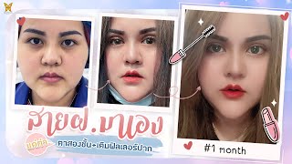 สายฝอ. มาเอง แค่ทำ ตาสองชั้น+ฟิลเลอร์ปาก หน้าก็เปลี่ยน I Review Bepround I EP.10