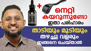 നെറ്റി കയറുന്നുണ്ടോ ഇതാ ഇതാ പരിഹാരം. താടിയും മുടിയും തഴച്ചു വളരും ഇങ്ങനെ ചെയ്താൽ | Dr varun Nambiar