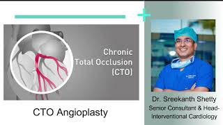 CTO Angioplasty | Sakra World Hospital