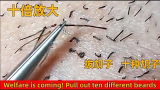 十倍放大拔胡子超爽视频！十种不同类型胡子大合集！Super cool video of beard plucking at 10x magnification!